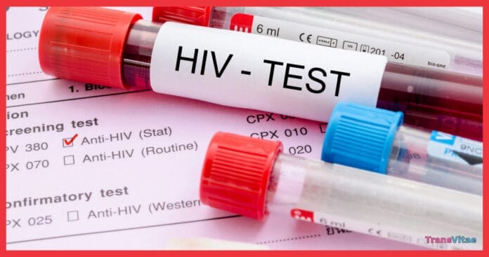 transgender hiv testing