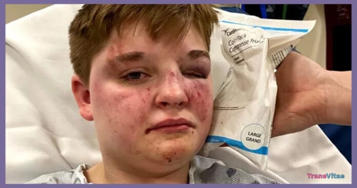 transgender lesbian hate crime