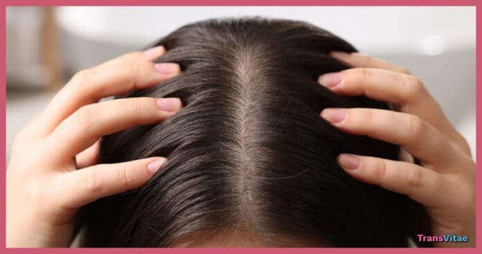 transgender scalp hair care